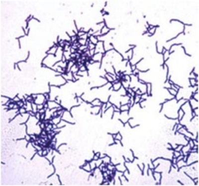 Image of organism in genus Actinomyces oris