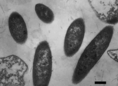 Image of organism in genus Anaerotruncus colihominis