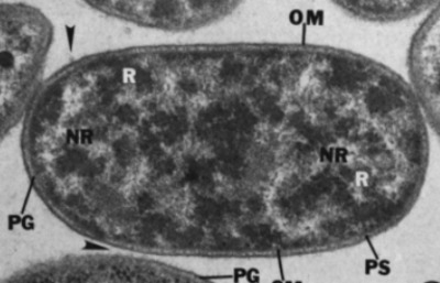 Image of organism in genus Bacteroides fragilis 1