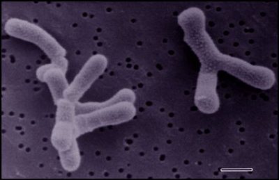 Image of organism in genus Bifidobacterium angulatum