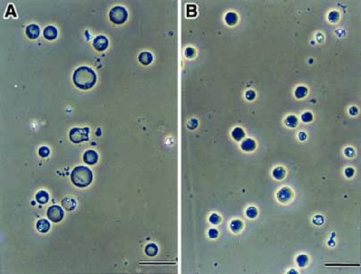 Image of organism in genus Blastocystis sp. subtype 3