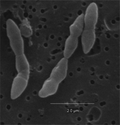 Image of organism in genus [Ruminococcus] sp. JC304