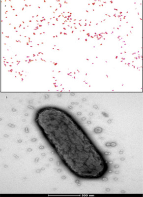 Image of organism in genus Butyricimonas virosa