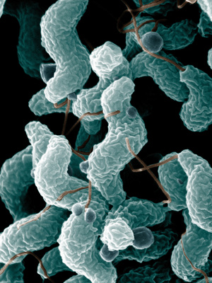 Image of organism in genus Campylobacter concisus 2