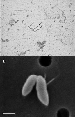 Image of organism in genus Catabacter sp. UBA1685 / Clostridia bacterium CIM:MAG 110_1