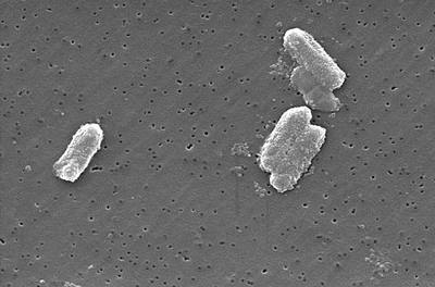 Image of organism in genus Citrobacter portucalensis