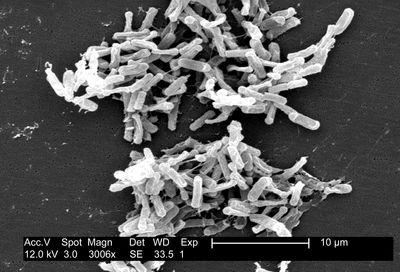 Image of organism in genus Clostridioides difficile