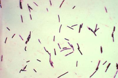 Image of organism in genus Clostridium perfringens