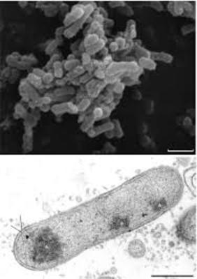 Image of organism in genus Coprobacter fastidiosus