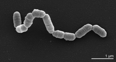 Image of organism in genus Cryptobacterium sp. CAG:338