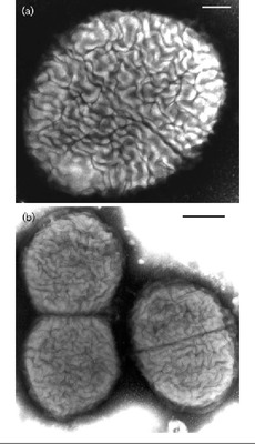 Image of organism in genus Dialister sp. CAG:486