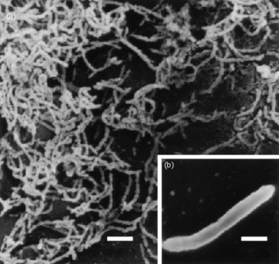 Image of organism in genus Dorea sp. CAG:105