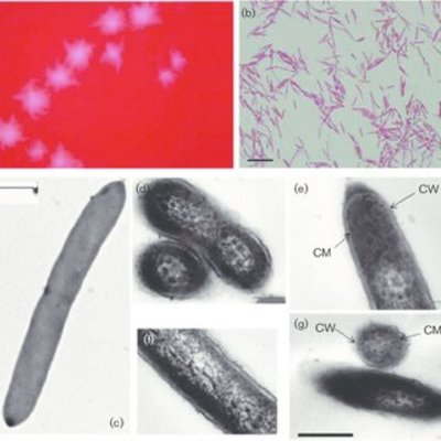 Image of organism in genus Eisenbergiella tayi