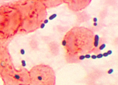 Image of organism in genus Enterococcus avium