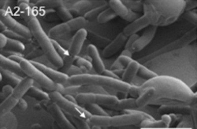 Image of organism in genus Faecalibacterium prausnitzii 7