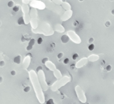 Image of organism in genus Faecalicoccus pleomorphus