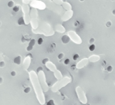 Image of organism in genus Faecalicoccus pleomorphus