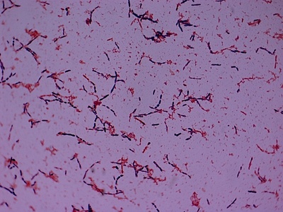 Image of organism in genus Fusicatenibacter saccharivorans