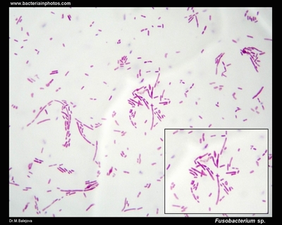 Image of organism in genus Fusobacterium ulcerans