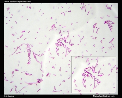 Image of organism in genus Fusobacterium nucleatum subsp. polymorphum