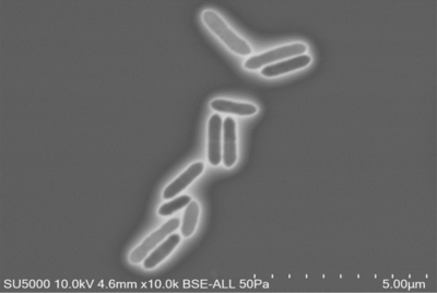 Image of organism in genus Gordonibacter urolithinfaciens