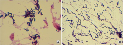 Image of organism in genus Granulicatella adiacens