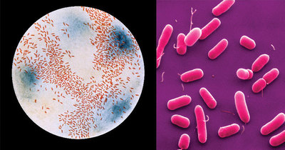 Image of organism in genus Haemophilus pittmaniae