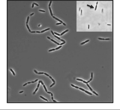 Image of organism in genus Hungatella hathewayi 1