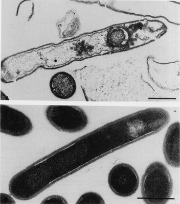 Image of organism in genus Lachnospira pectinoschiza