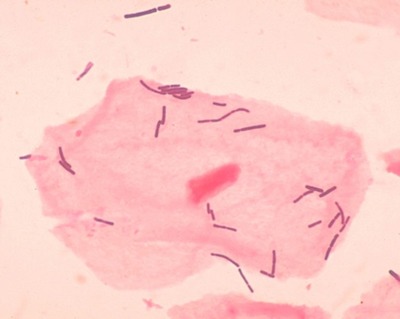 Image of organism in genus Lactobacillus crispatus