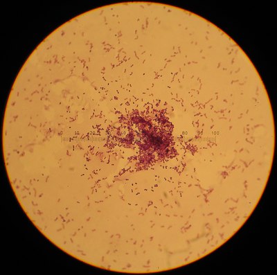 Image of organism in genus Lactococcus lactis subsp. cremoris