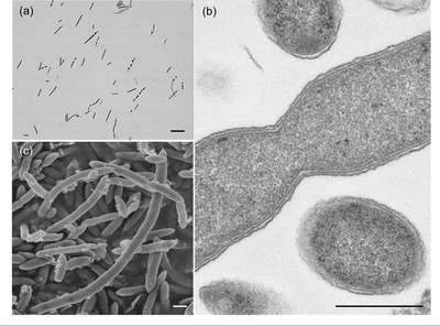 Image of organism in genus Lawsonibacter asaccharolyticus