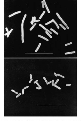 Image of organism in genus Mitsuokella jalaludinii