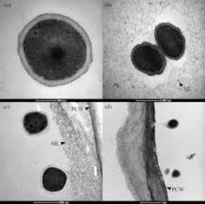 Image of organism in genus Monoglobus pectinilyticus