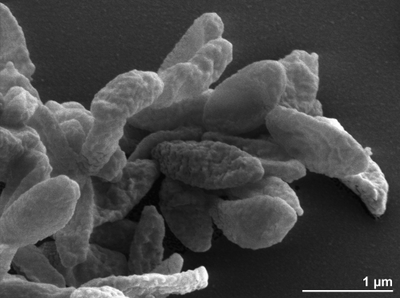 Image of organism in genus Odoribacter splanchnicus