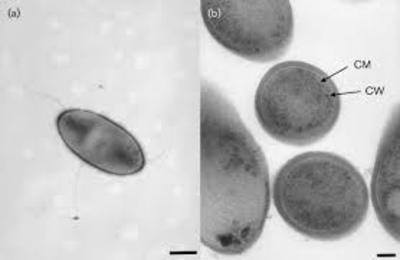 Image of organism in genus Oribacterium sinus