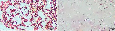 Image of organism in genus Oxalobacter formigenes 2