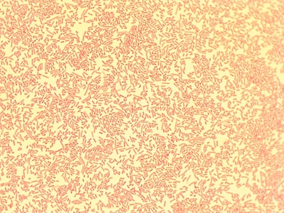 Image of organism in genus Parabacteroides distasonis