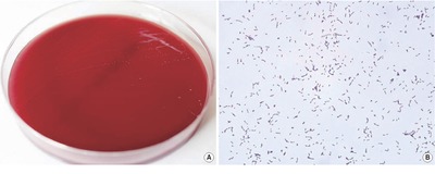 Image of organism in genus unclassified Paraeggerthella