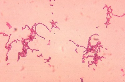 Image of organism in genus Parvimonas micra