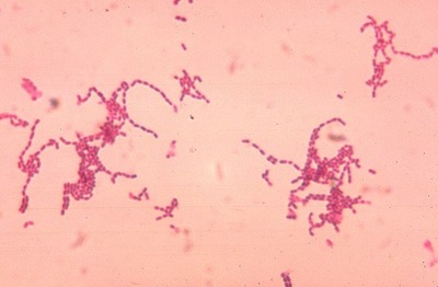 Image of organism in genus Parvimonas sp. KA00067