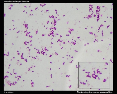 Image of organism in genus Peptostreptococcus stomatis
