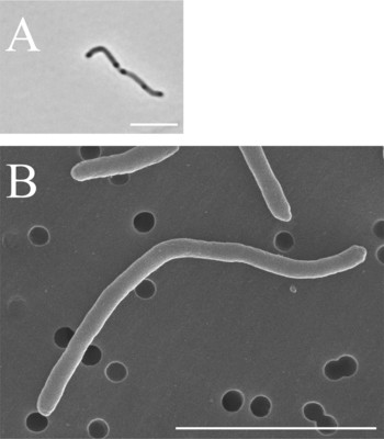 Image of organism in genus Phascolarctobacterium faecium