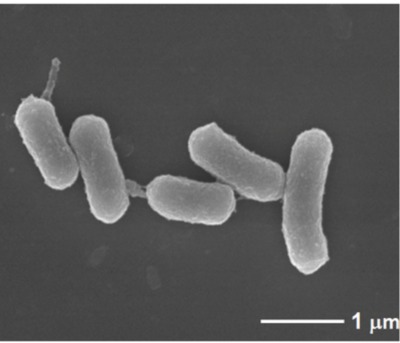 Image of organism in genus Porphyromonas asaccharolytica