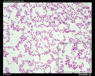 Image of organism in genus Prevotella melaninogenica