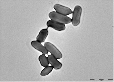 Image of organism in genus Raoultella ornithinolytica