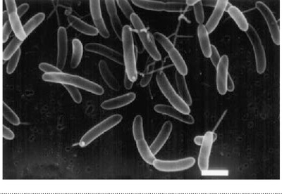Image of organism in genus [Eubacterium] rectale