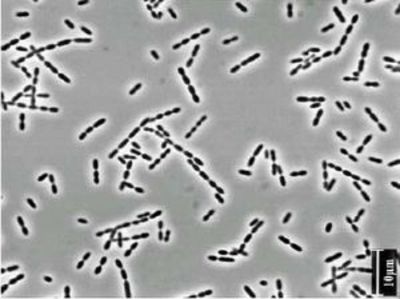 Image of organism in genus Ruminococcus sp. CAG:488