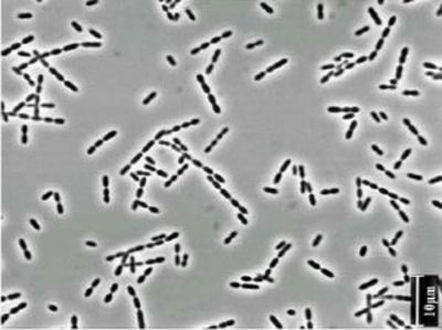 Image of organism in genus Ruminococcus sp. CAG:177