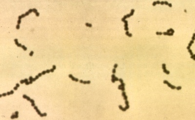 Image of organism in genus Streptococcus oralis
